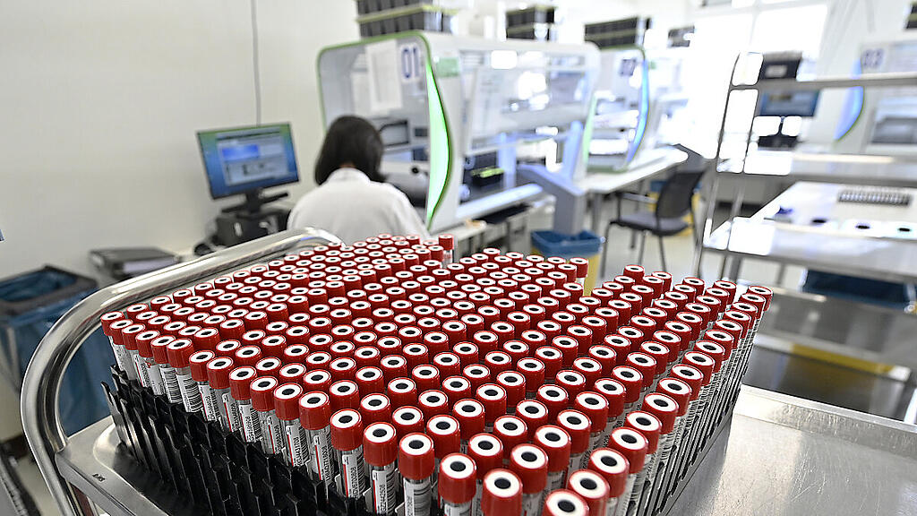 Die Test-Kits von Lead Horizon beschäftigen das Wiener Handelsgericht