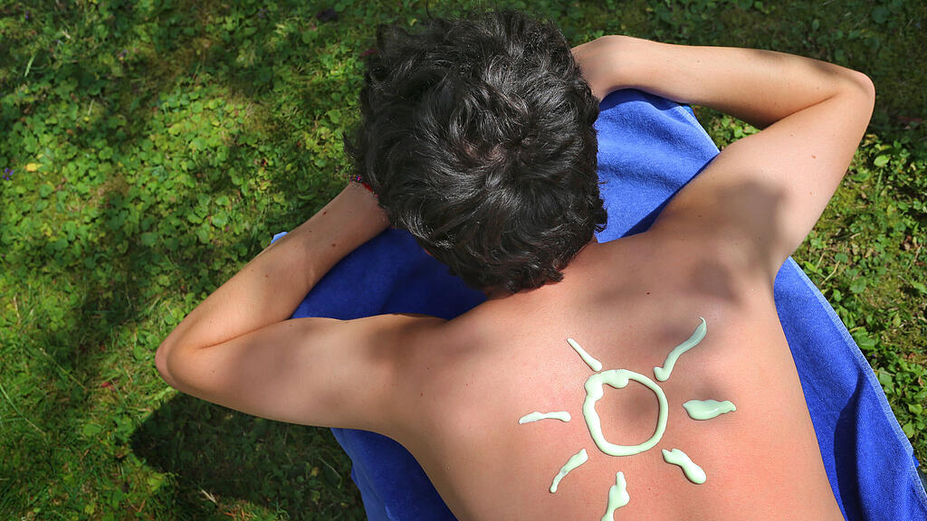 Sonnenbrand