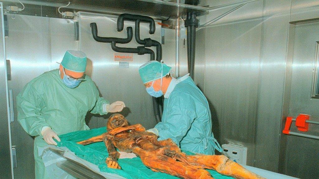 Das war Ötzi