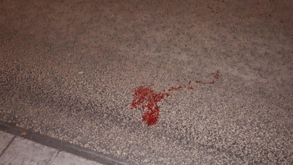 Blutige Gewaltattacke in Griesgasse