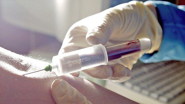 Zahl der Infektionen ist leicht rückläufig