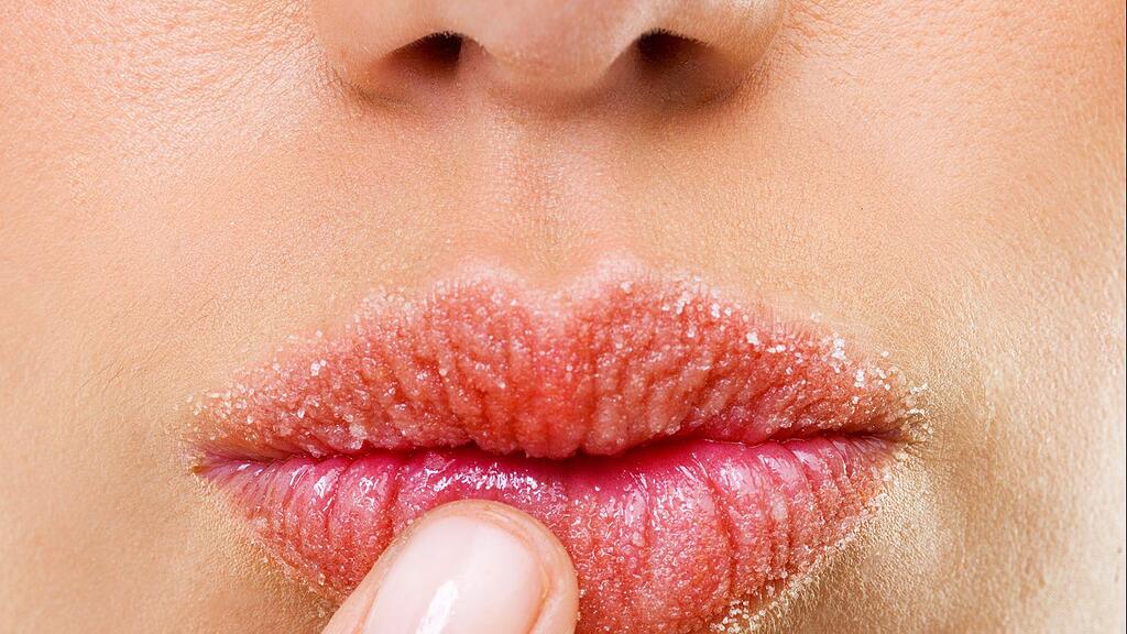 Sonnenbarnd auf den Lippen?