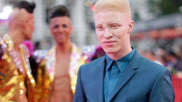 Life Ball 2014: Erste Gäste am Magenta Carpet (Kostüme)