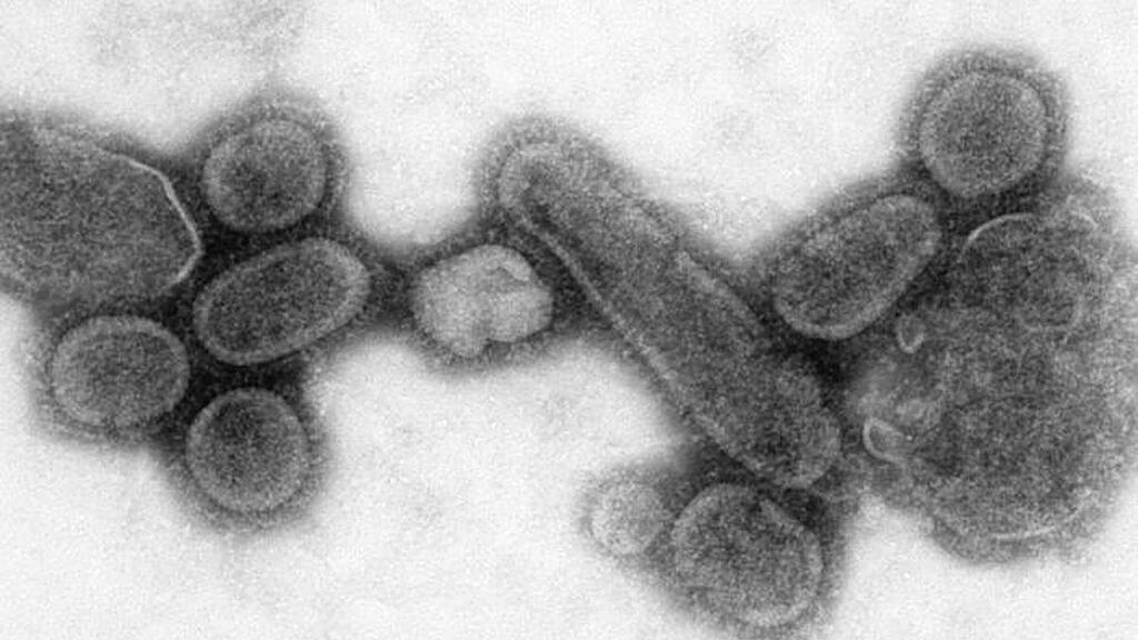 H1N1-Virus löste 2009 eine Pandemie aus