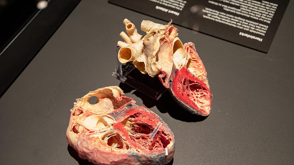 Ausstellung Körperwelten Salzburg I