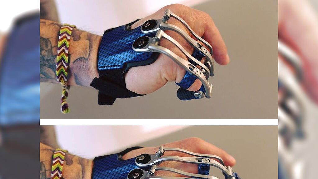 Finger-Prothese