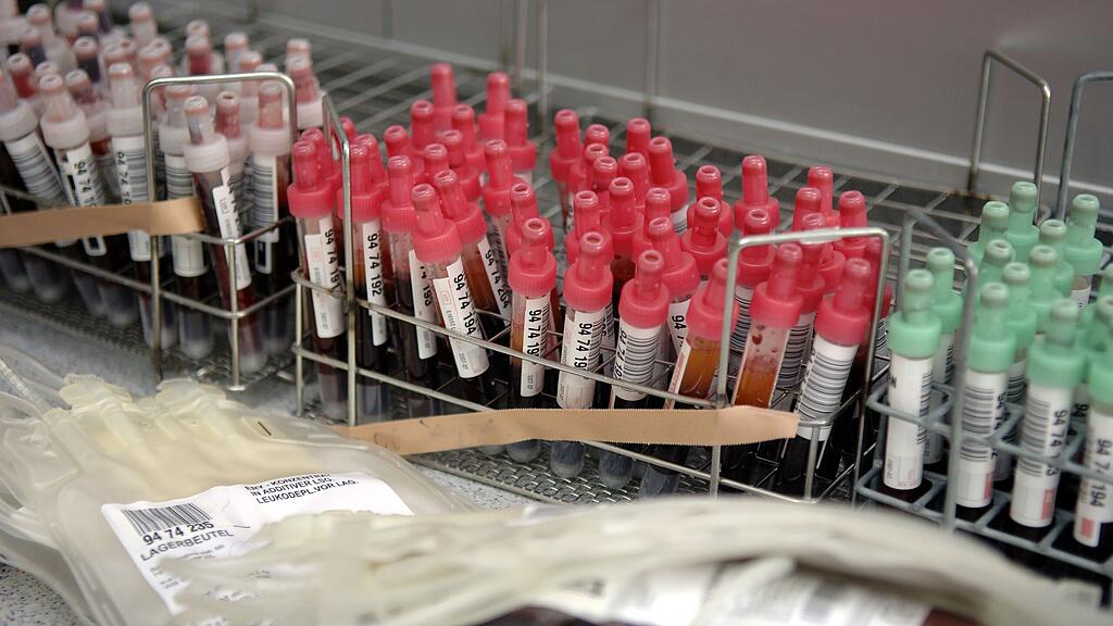 Doping, Blut, SB