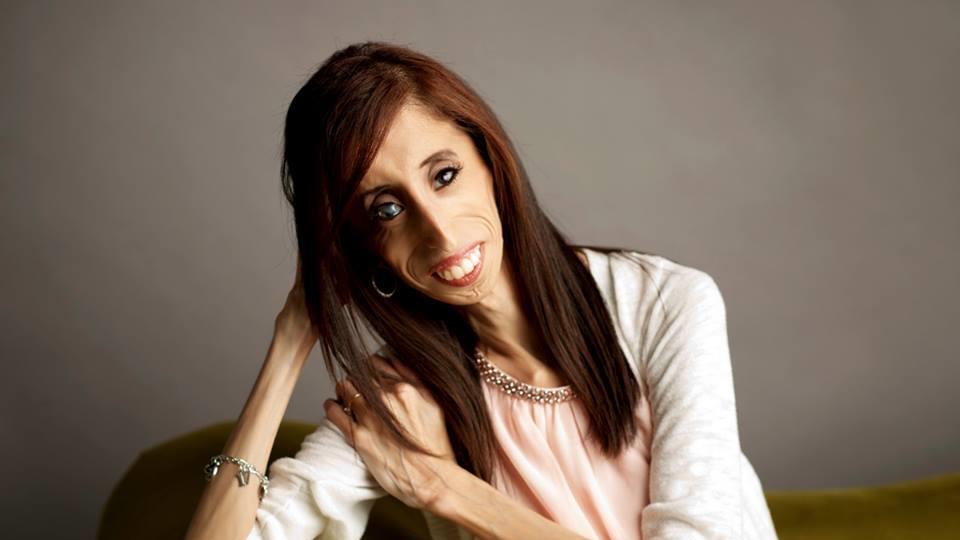 Hässlichste Frau der Welt? Lizzie Velásquez (24) lässt sich nicht mobben