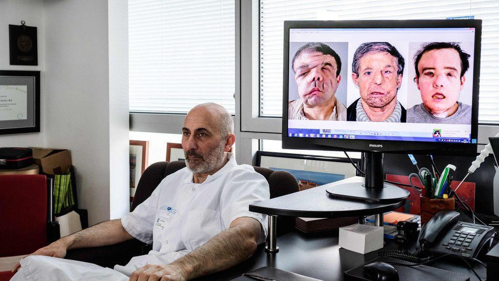 Gesichtstransplantation: Bilder der OP und des Patienten