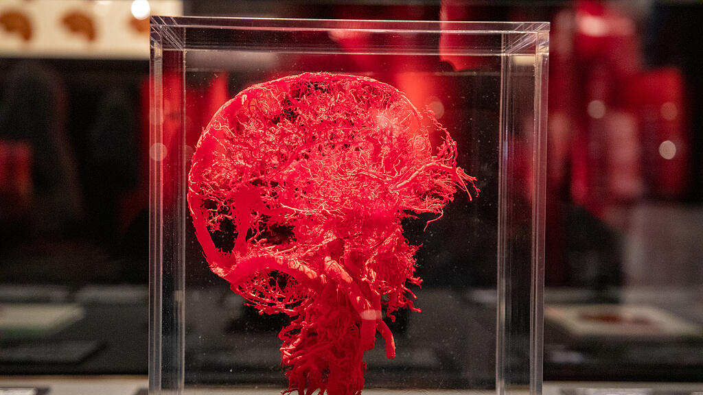 Ausstellung Körperwelten Salzburg I