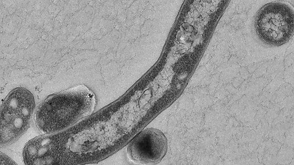 Tuberkulose-Erreger unter dem Mikroskop