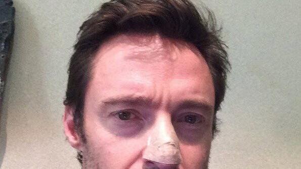 Hugh Jackman mit Pflaster auf Nase - wegen Hautkrebs behandelt