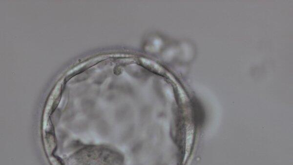 "Fehler" bei In-Vitro-Fertilisation?