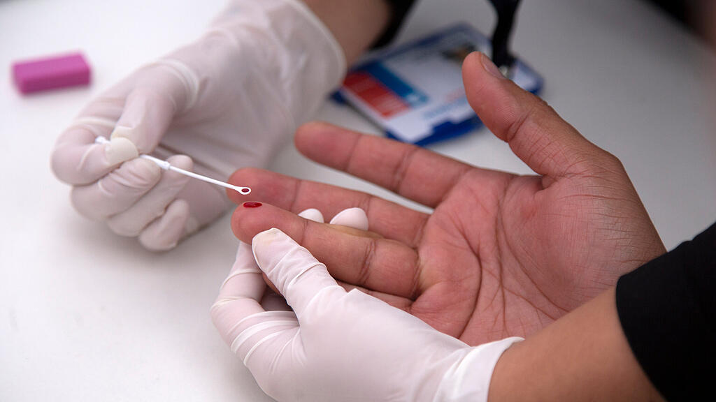 HIV