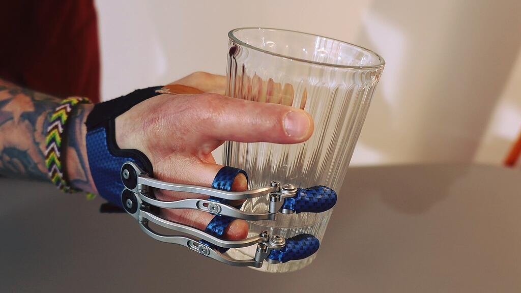 Finger-Prothese
