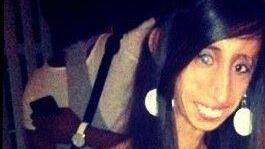 Hässlichste Frau der Welt? Lizzie Velásquez (24) lässt sich nicht mobben