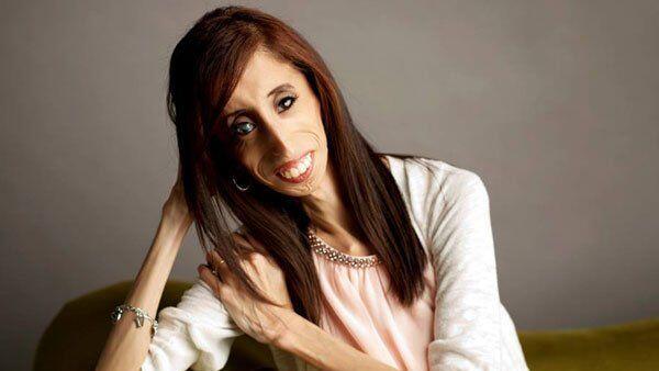 In der Highschool als "hässlichste Frau der Welt" beschimpft, heute Motivationstrainerin: Lizzie Velásquez.