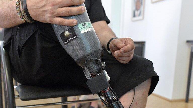 Die fühlende Beinprothese