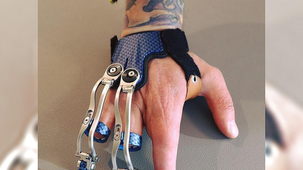 Finger-Prothese