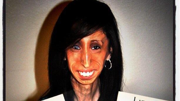Hässlichste Frau der Welt? Lizzie Velásquez (24) lässt sich nicht mobben