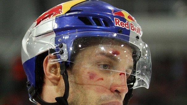 Red Bulls - KAC