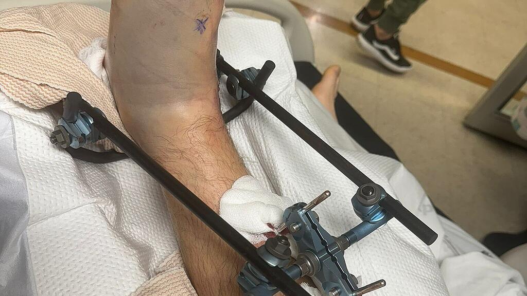 Matthias Walkner schwer verletzt