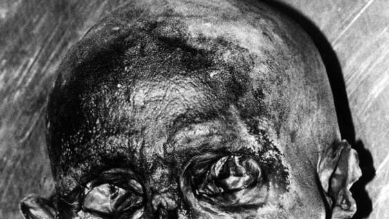 Archivbilder von Ötzi