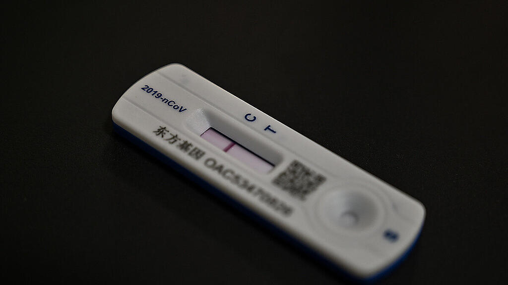 Für Risikopatienten soll der Test beim Arzt wieder gratis werden