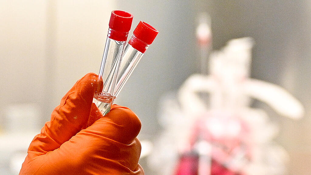 Coronavirus, Test, SB