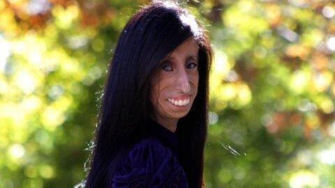 Hässlichste Frau der Welt? Lizzie Velásquez (24) lässt sich nicht mobben