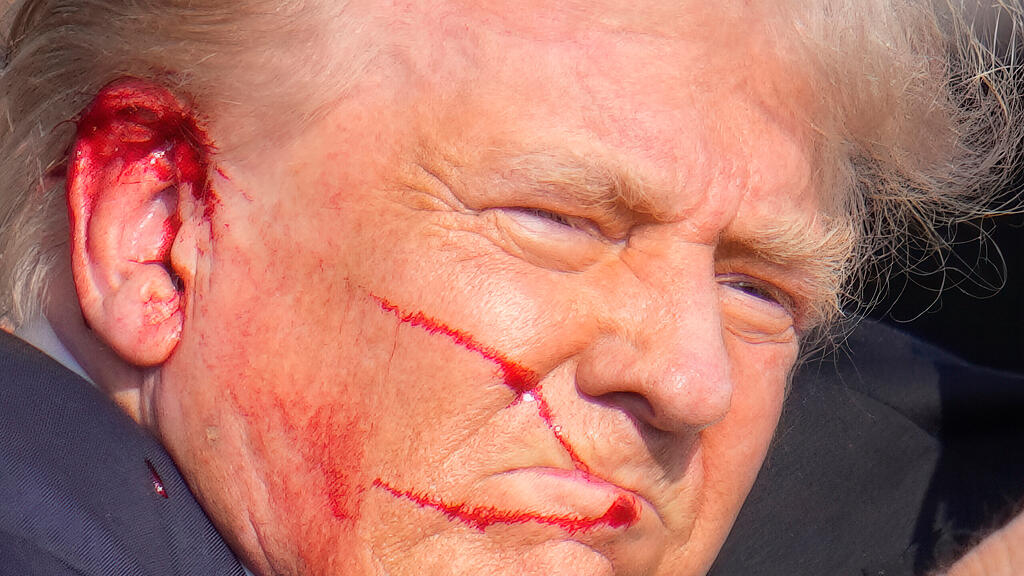 Trump Sch\u00fcsse