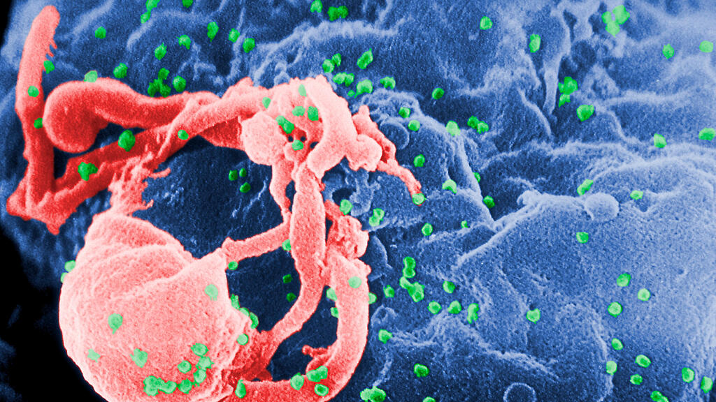 HIV, Aids, Virus, SB