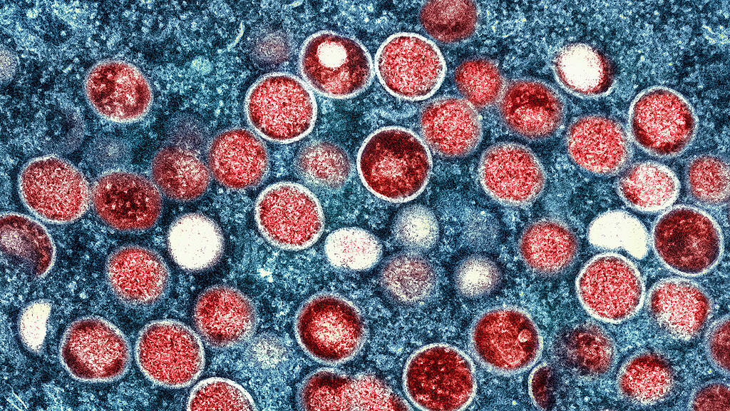 WHO ruft wegen Mpox weltweite Notlage aus