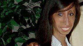 Hässlichste Frau der Welt? Lizzie Velásquez (24) lässt sich nicht mobben