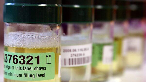 Täglich neue Enthüllungen aus den Doping-Labors