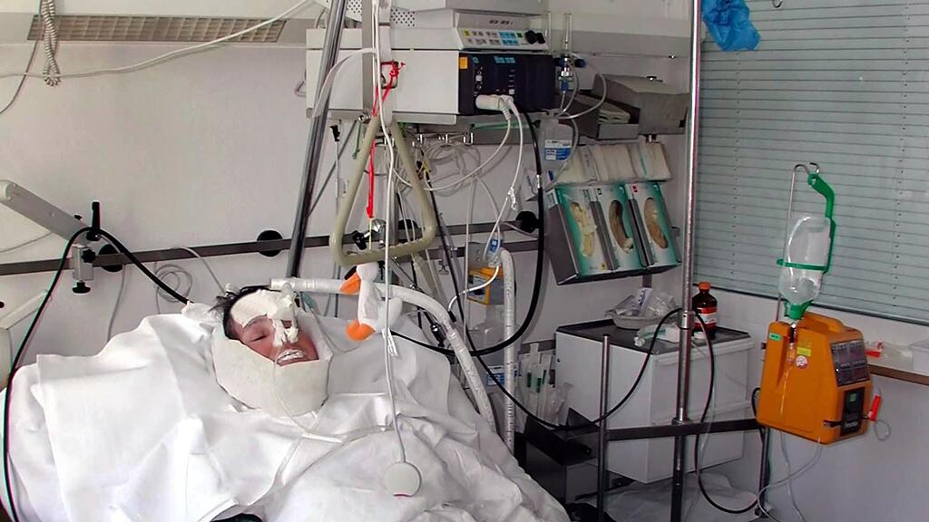 Nur drei Tage nach der Ultraschall-Behandlung war der Koma-Patient ansprechbar (Symbolbild).