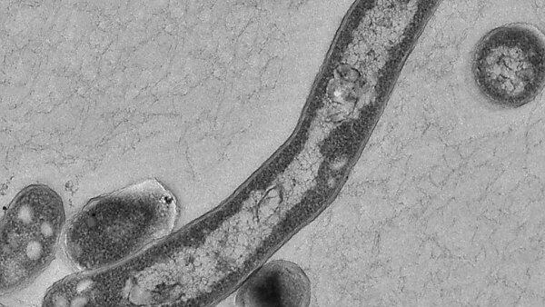 Gestatten: TBC-Erreger Mycobacterium tuberculosis
