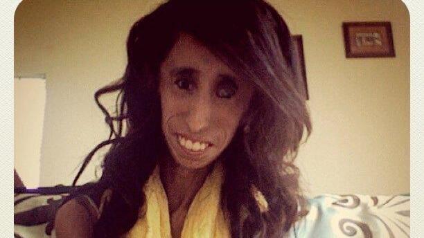 Hässlichste Frau der Welt? Lizzie Velásquez (24) lässt sich nicht mobben