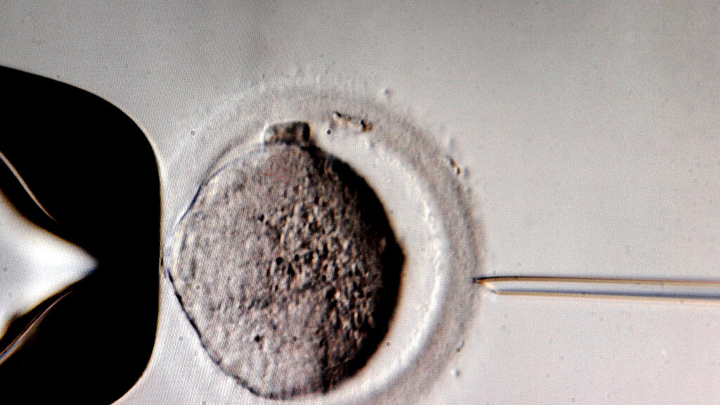 In Großbritannien droht das Sperma für künstliche Befruchtung auszugehen (Symbolbild)