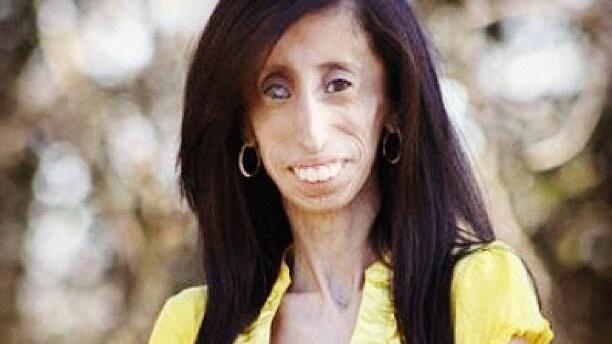 Hässlichste Frau der Welt? Lizzie Velásquez (24) lässt sich nicht mobben