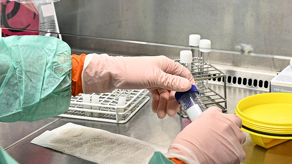 Coronavirus, Labor, Abstrich, SB