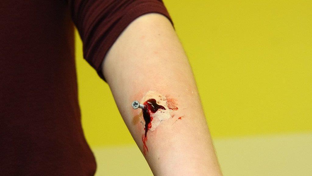Erste-Hilfe-Landesbewerb im BAKIP