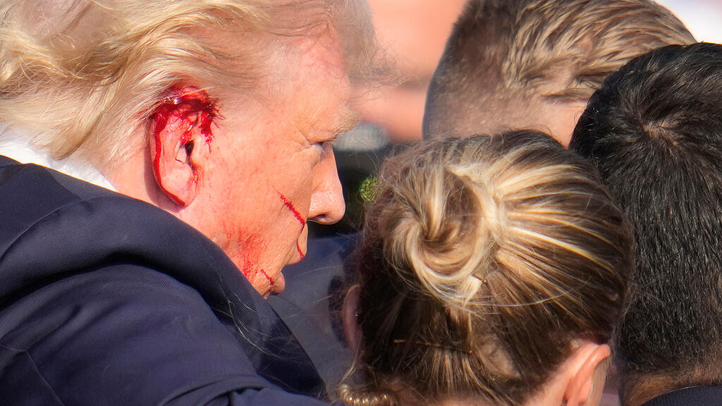 Trump Sch\u00fcsse