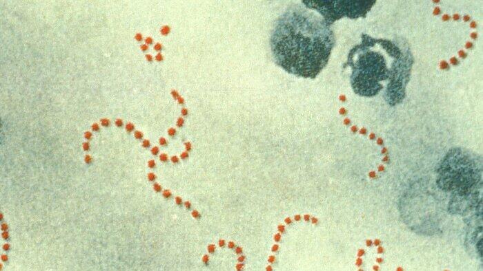 Streptococcus_pyogenes.jpg