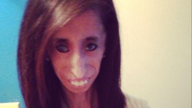 Hässlichste Frau der Welt? Lizzie Velásquez (24) lässt sich nicht mobben