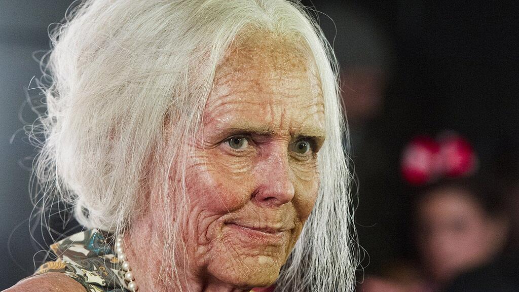 Heidi Klum mit Falten und Krampfadern.