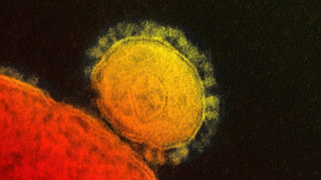 Der neue Coronavirus ist sogar noch tödlicher als SARS, allerdings ist er weniger ansteckend.
